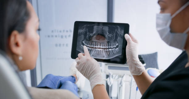 Licensed Tooth Extraction service in Laurens, SC - Smile Center Dentistry
